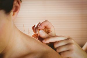 Acupuncture is a complementary medicine